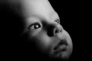 Glaucoma The Silent Thief of Sight – Early Detection Saves Vision
