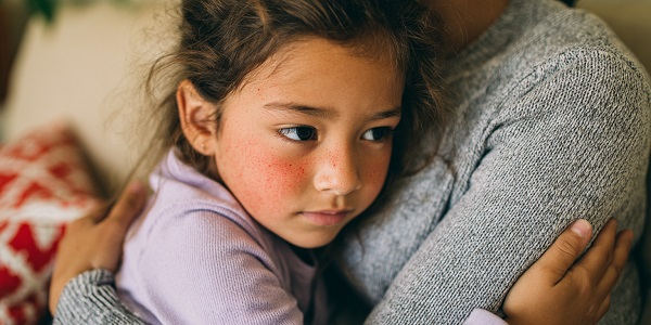 What To Do When Your Child Has a Sudden Severe Allergic Reaction or Anaphylactic Shock