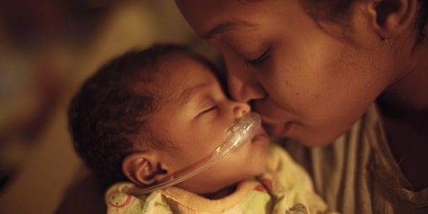 Understanding Cleft Lip and Palate in Babies