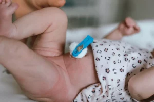 Umbilical cord clamping after birth